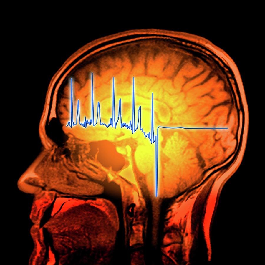 Ecg Trace And Mri Brain Scan Photograph By Alfred Pasiekascience Photo