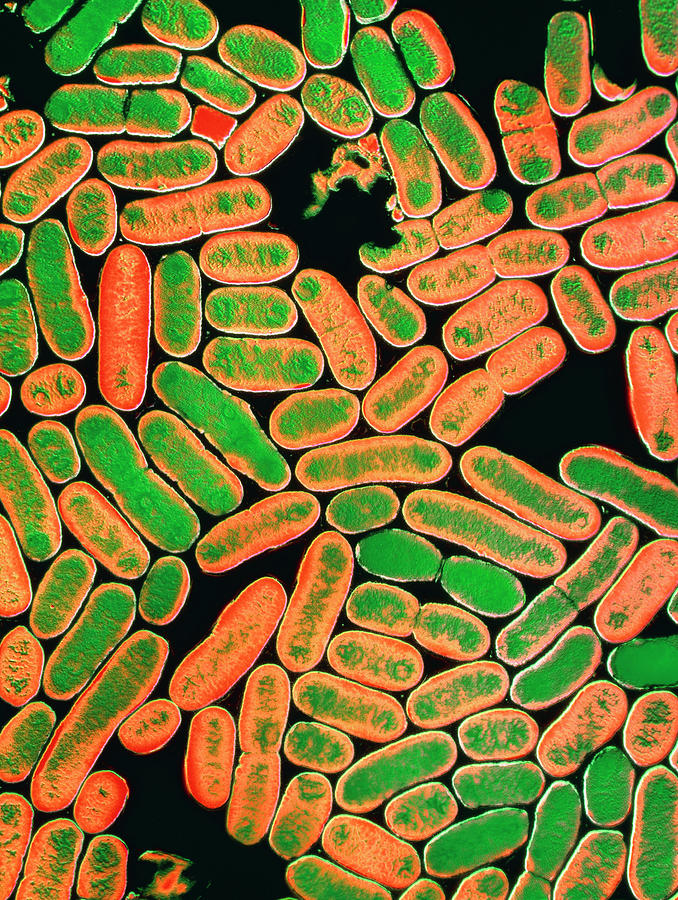 E.coli Photograph by E. Gray/science Photo Library