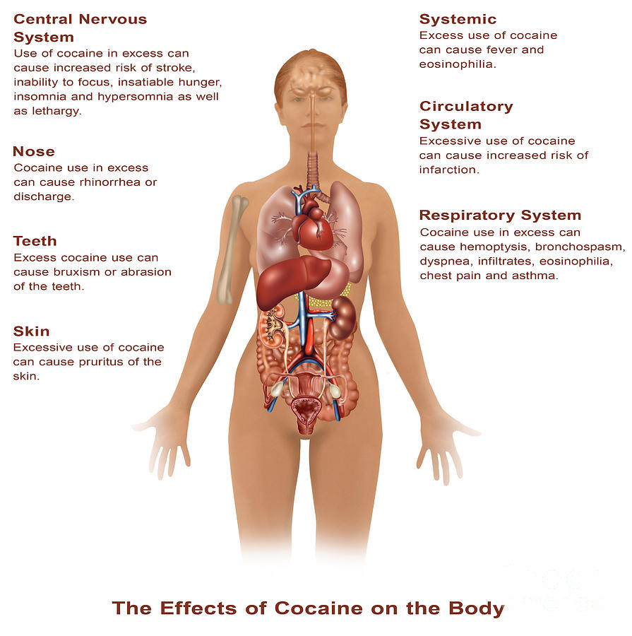 Effects Of Cocaine Use Photograph by Gwen Shockey