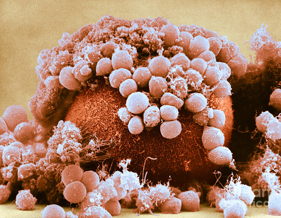 Egg And Cumulus Cells, Sem Photograph by David M. Phillips