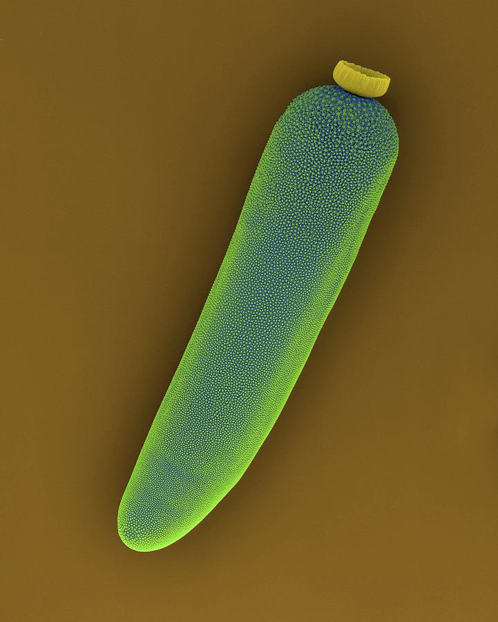 Egg Case Of A Mosquito Photograph by Science Photo Library Egg Case Of A Mosquito Photograph by Science Photo Library