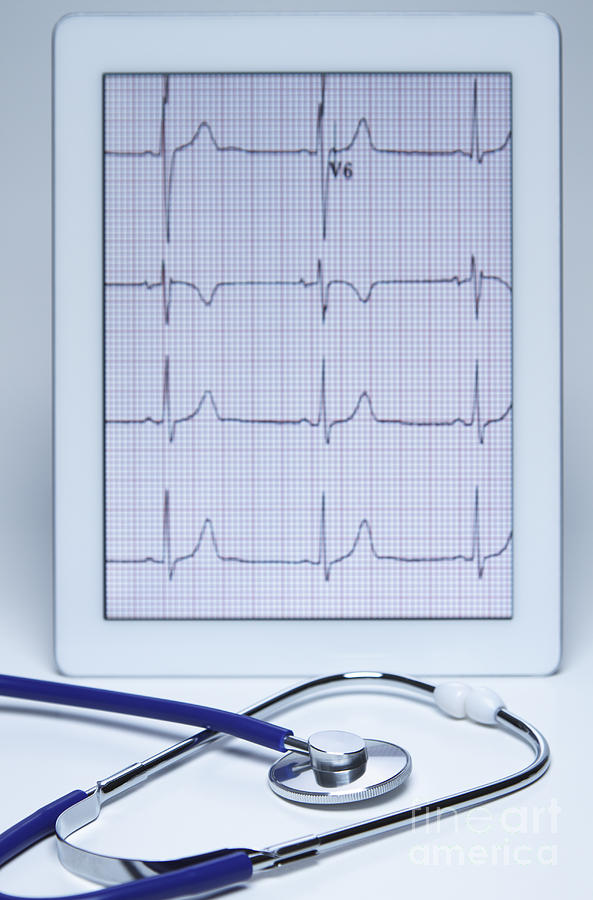 Electrocardiogram On An Ipad Photograph by GIPhotoStock