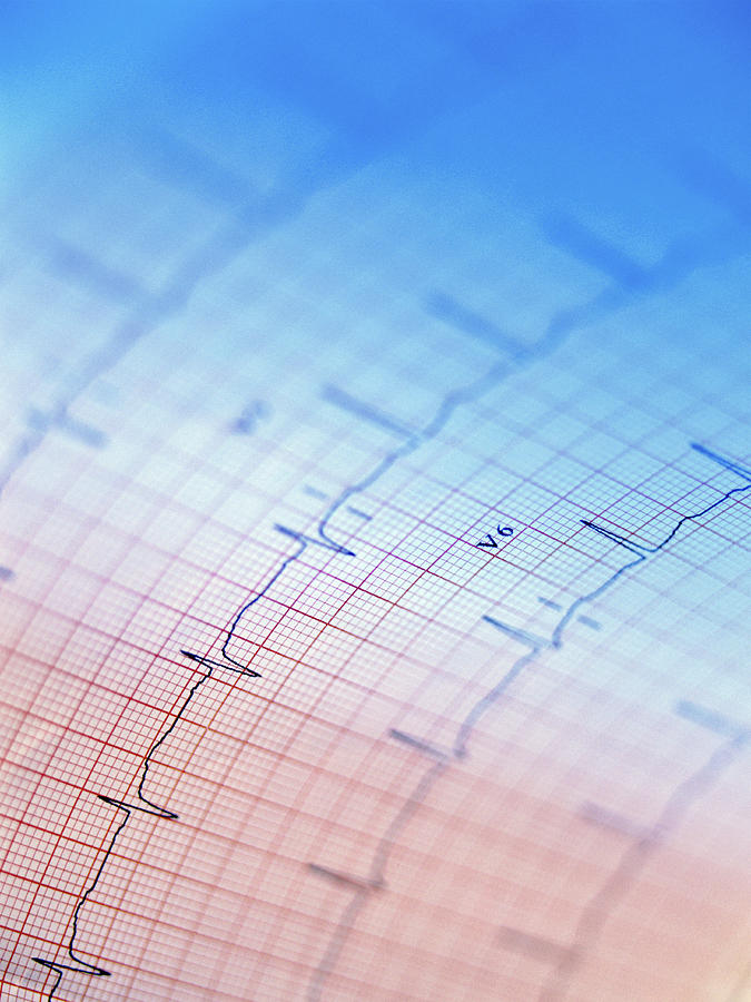 Electrocardiogram Photograph by Steve Allen/science Photo Library
