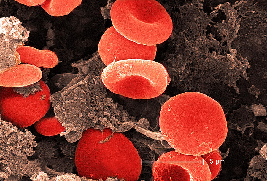 Electron micrograph of red blood cells and fibrin Photograph by Callista Images