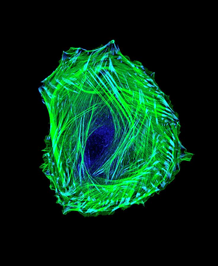 Embryonic Smooth Muscle Cell Photograph by Vira V. Artym, Lcdb/nidcr/national Institutes Of Health
