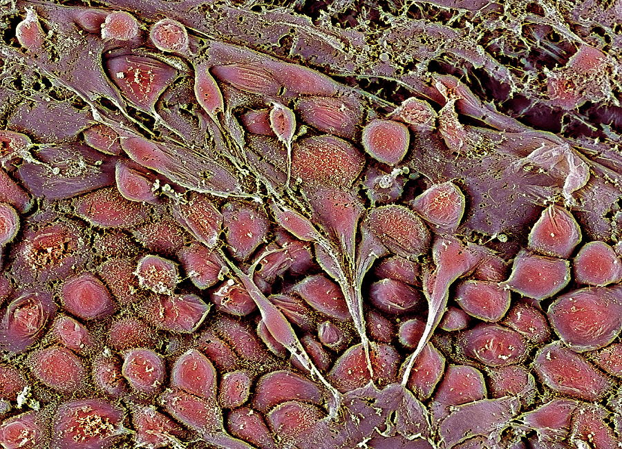 Embryonic Stem Cells Photograph by Professor Miodrag Stojkovic/science Photo Library