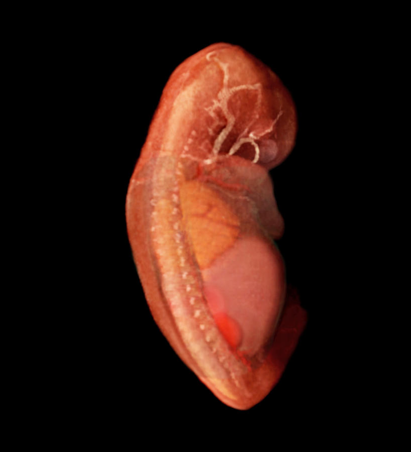 Embryonic Urinary System Photograph by Anatomical Travelogue