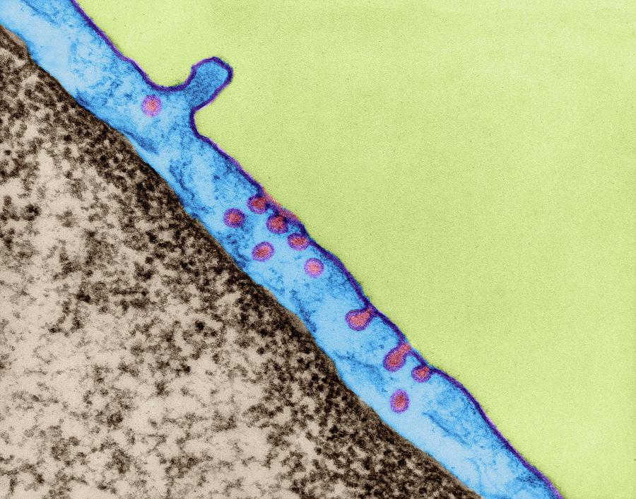 Endocytosis By A Capillary Endothelial Cell Photograph by Dennis Kunkel ... Biology Diagrams