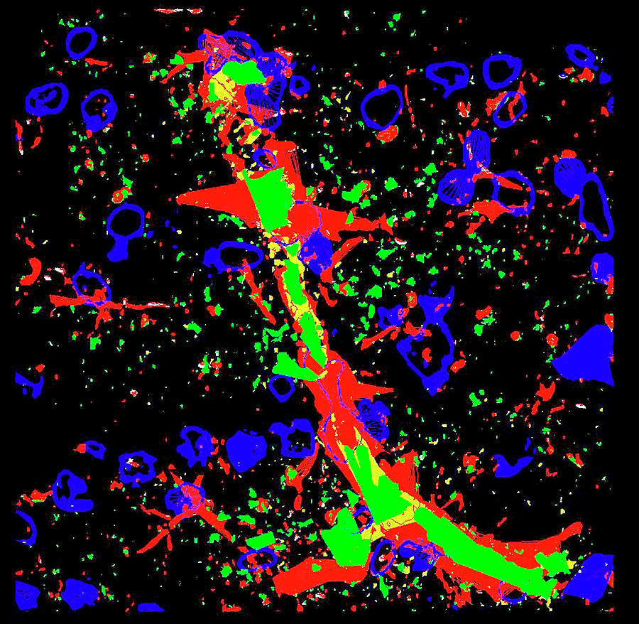 Endothelial Nitric Oxide In The Brain Photograph by R. Bick, B