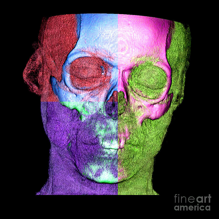 Enhanced 3d Ct Of Face And Skull Photograph by Living Art Enterprises