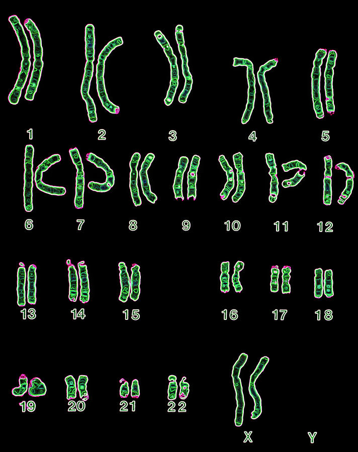 Enhanced Lm Of Normal Female Chromosomes Photograph By Dept Of Clinical Cytogenetics 