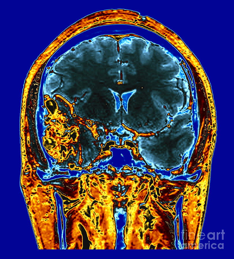 Кт головы москва. Ликворография головного мозга магнитно-резонансная. Мрт головного мозга. Кт головного мозга с контрастом. Кт головы.