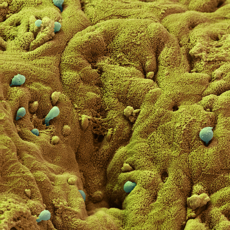 Entamoeba Histolytica Photograph by Eye of Science