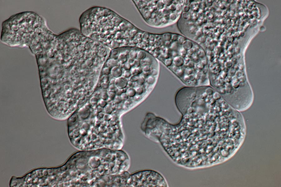 Entamoeba Histolytica Photograph - Entamoeba Histolytica Protozoa by Sinclair Stammers