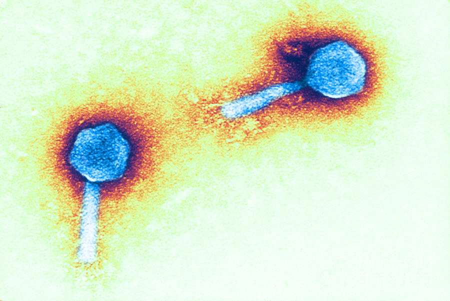 Enteriobacteria Phage P1 Tem Photograph by Biology Pics