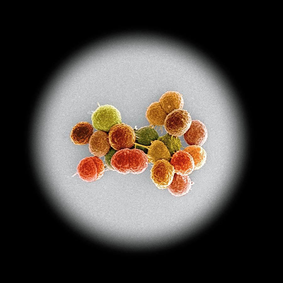 Enterococcus Faecalis Photograph - Enterococcus Faecalis Bacteria by Science Photo Library