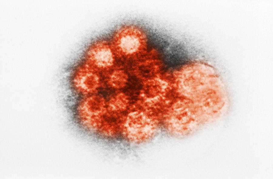 Enterovirus, Tem Photograph by Science Source