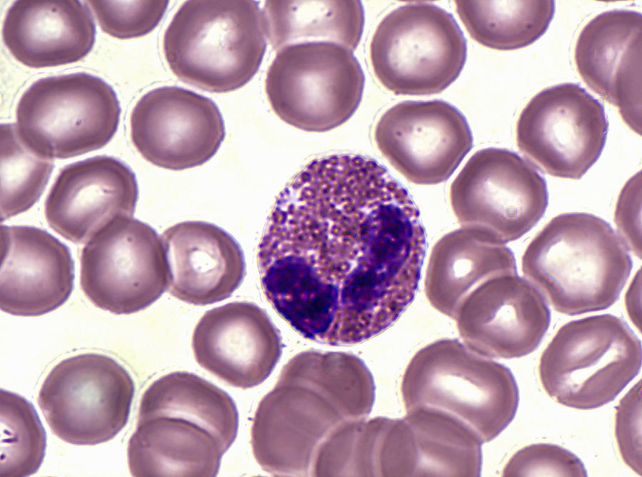 Eosinophil And Erythrocytes Lm Photograph by Alvin Telser