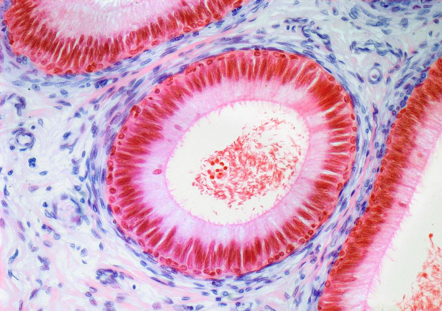 Epididymis by Steve Gschmeissner/science Photo Library