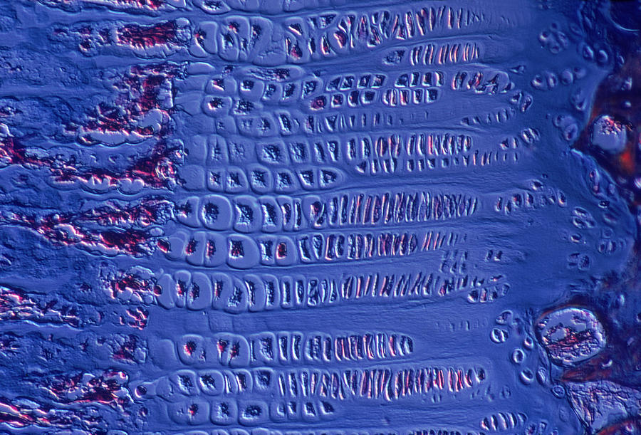 Epiphyseal Growth Plate Photograph by Joaquin Carrillo-Farga