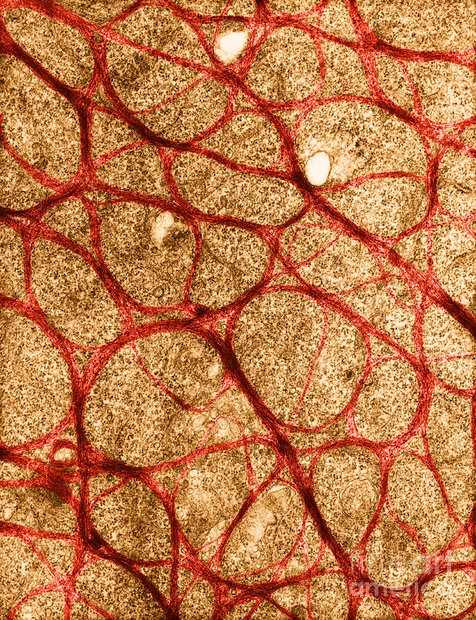 Epithelial Cell From Cervix, Tem Photograph by David M. Phillips