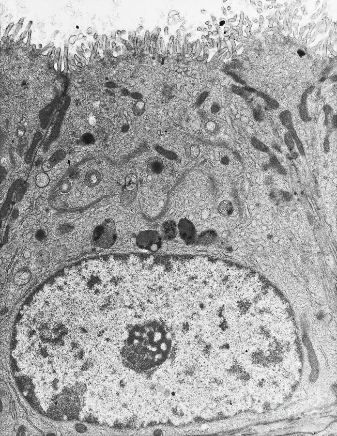 Epithelial Cell, Tem Photograph by David M. Phillips