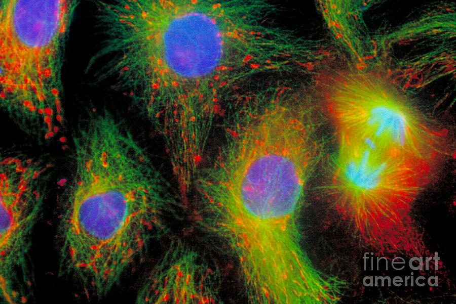 Epithelial Cells In Mitosis Photograph by Jennifer C Waters