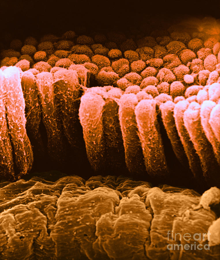 Epithelial Cells, Sem Photograph by David M. Phillips