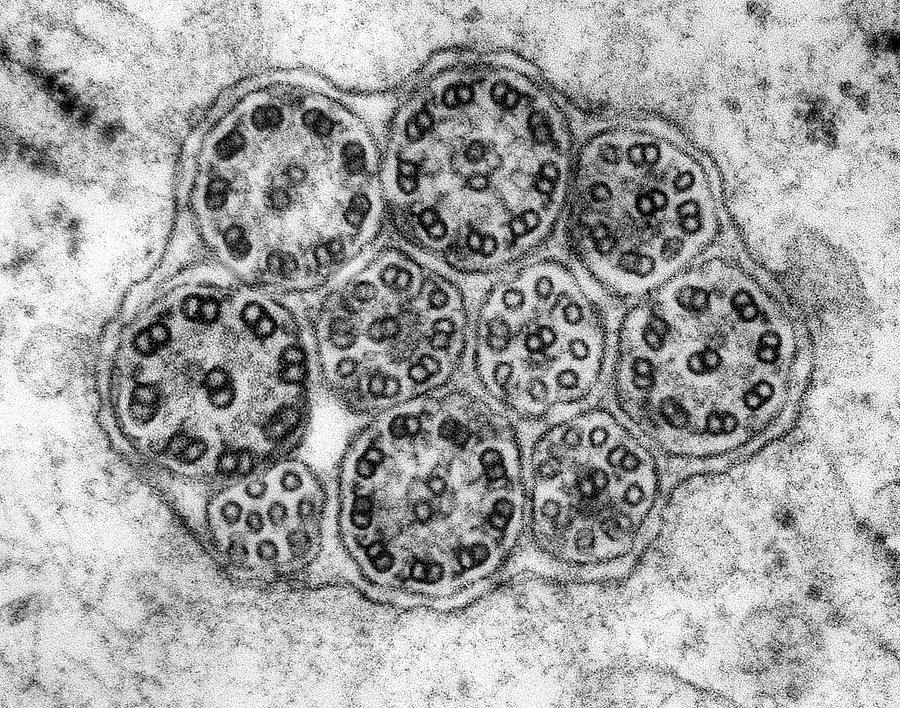 Epithelial Cilia Microtubules (cross Section) Photograph by Dennis ...