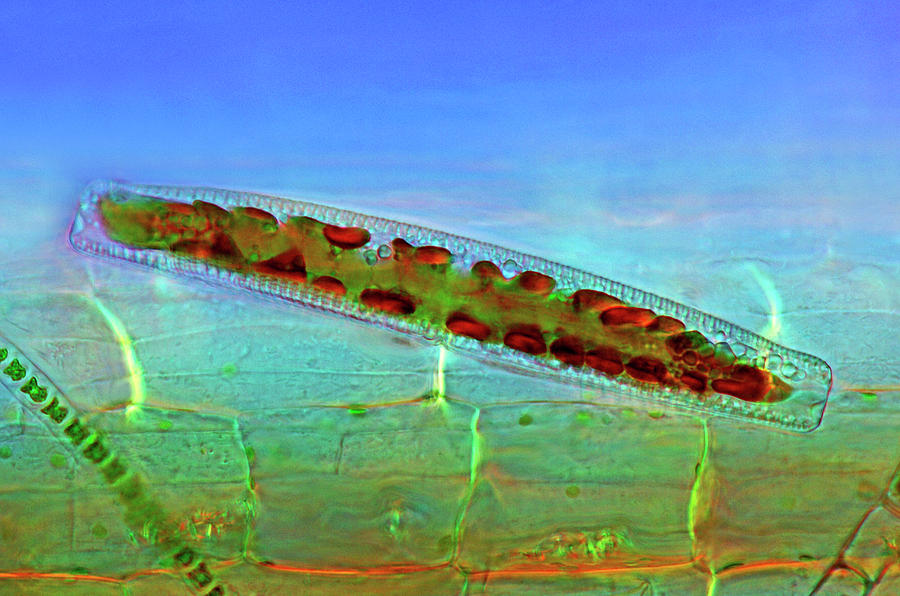 Epithemia Diatom Photograph by Marek Mis