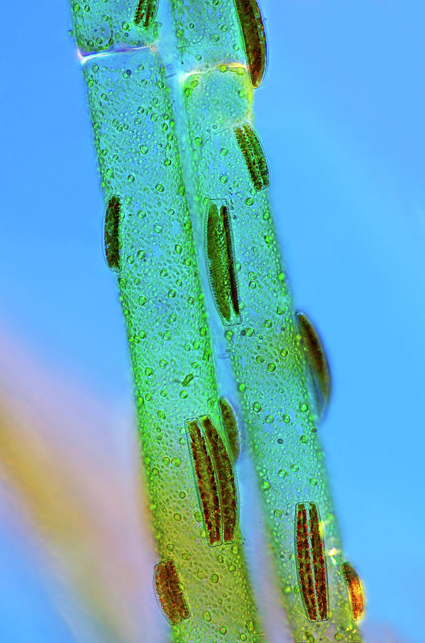 Epithemia Diatoms Photograph by Marek Mis