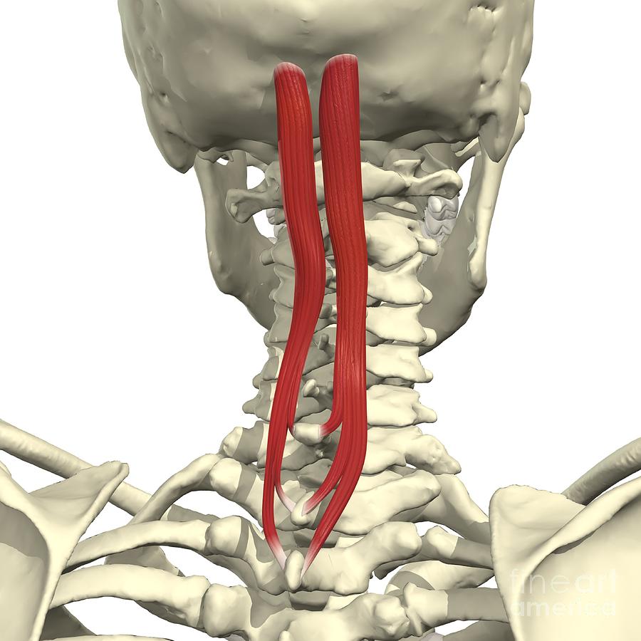 Erector Spinae: Spinalis Capitis Photograph by Medical Images ...