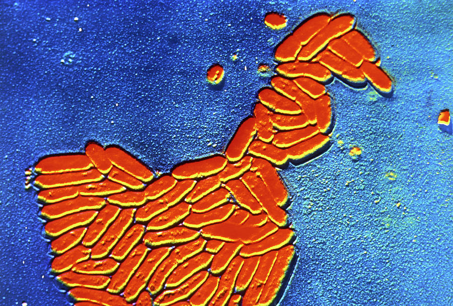 Erysipelothrix Rhusio- Pathiae Bacteria Photograph by Cnri/science Photo Library