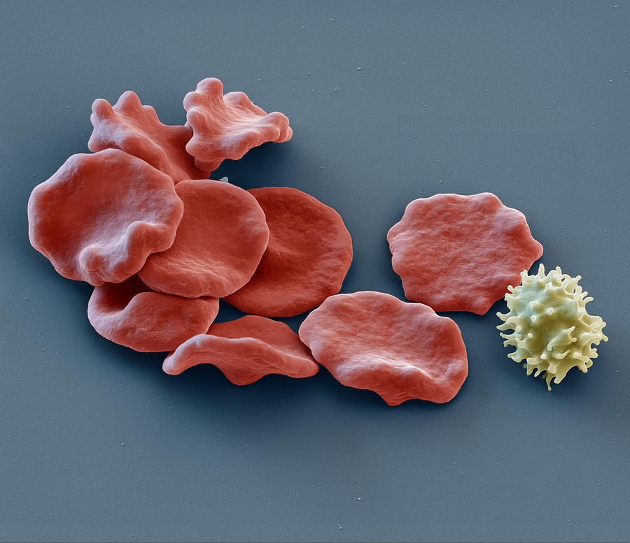 Erythrocytes And Lymphocytes, Sem Photograph by Eye of Science