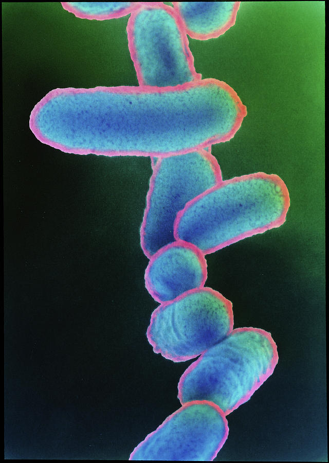 Bacteria Photograph - Escherichia Coli 0157:h7 Bacteria by Dr Kari Lounatmaa/science Photo Library