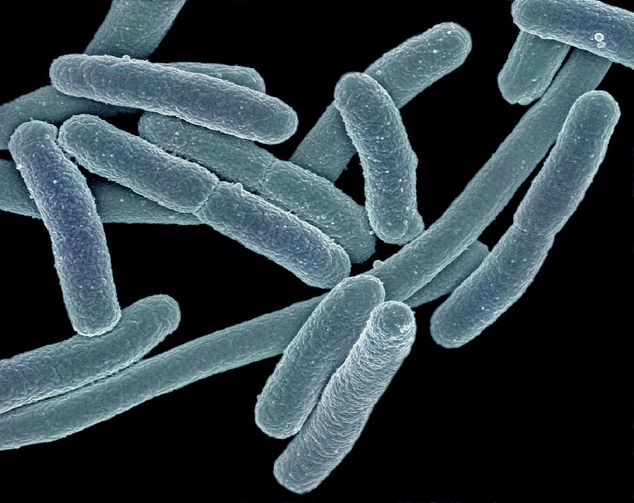 Escherichia Coli Bacteria Photograph by Science Stock Photography/science Photo Library