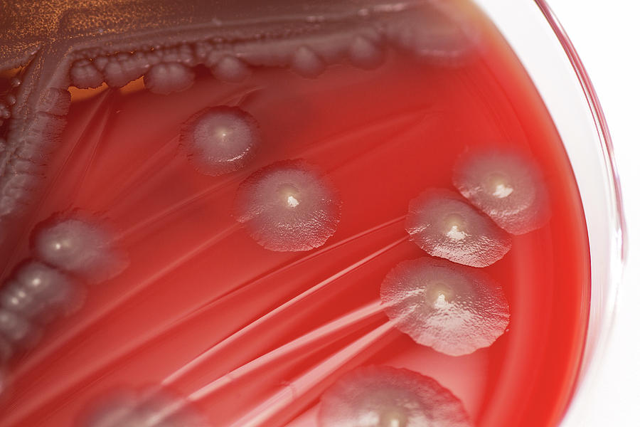 Escherichia Coli Photograph - Escherichia Coli Bacterial Culture by Daniela Beckmann / Science Photo Library
