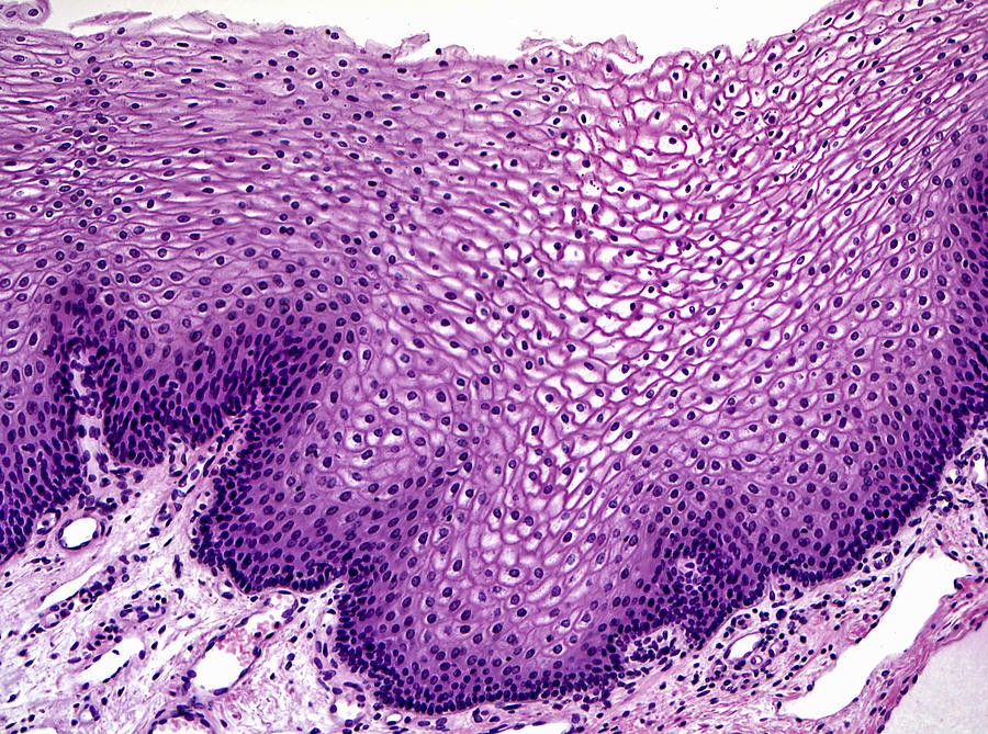 Esophageal Epithelium Lm Photograph by Alvin Telser