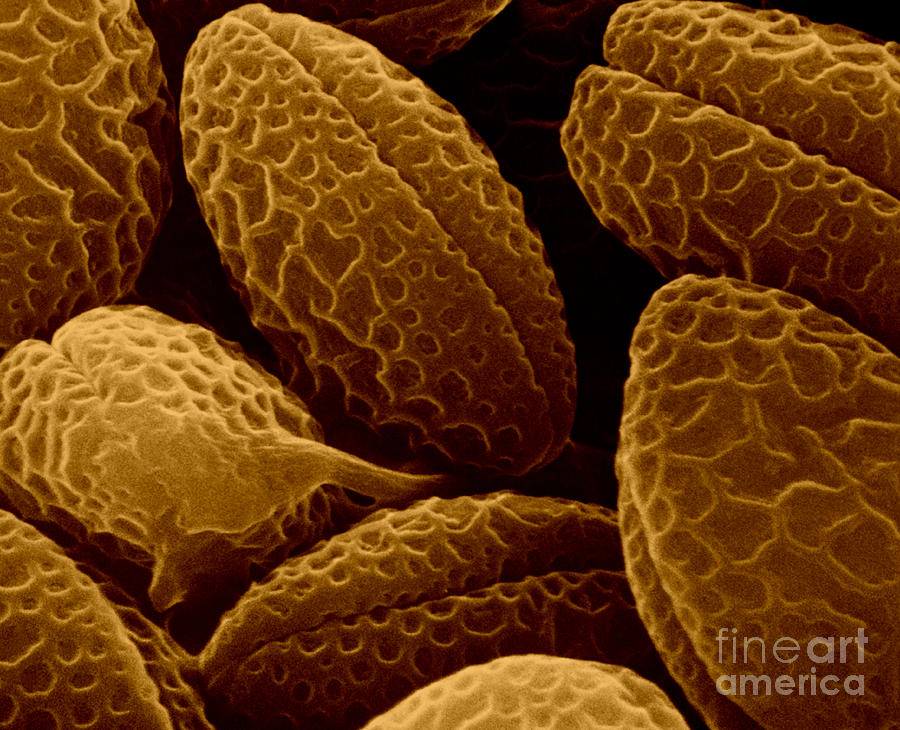 Eucryphia Pollen Grain Sem Photograph by Joseph F. Gennaro Jr.