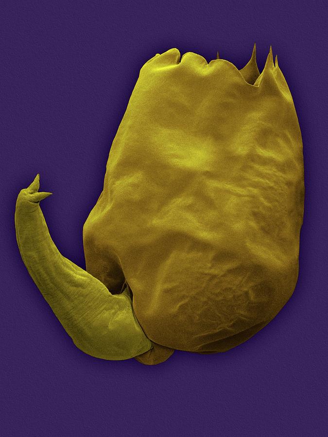 Fish Photograph - Euryhaline Rotifer (brachionus Plicatilis) by Dennis Kunkel Microscopy/science Photo Library