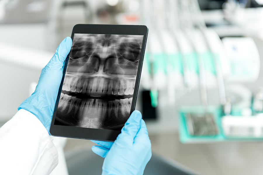 Expertise of dental radiogram on tablet Photograph by Yoh4nn