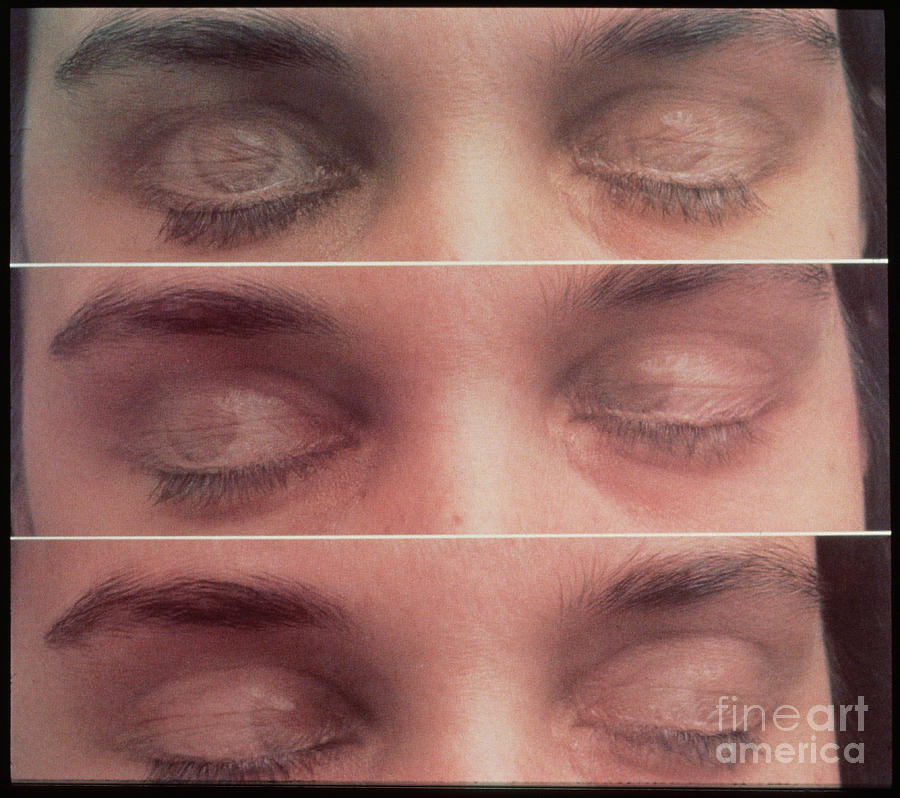 eye-movement-in-rem-sleep-photograph-by-allan-hobson-fine-art-america