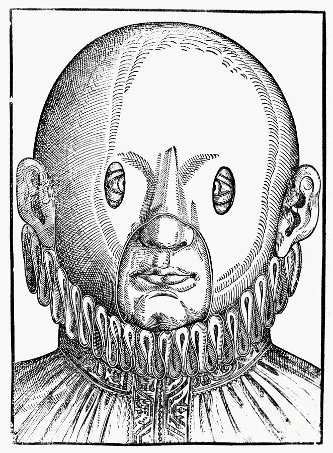 1583 Photograph - Eye Treatment, 1583 by Granger