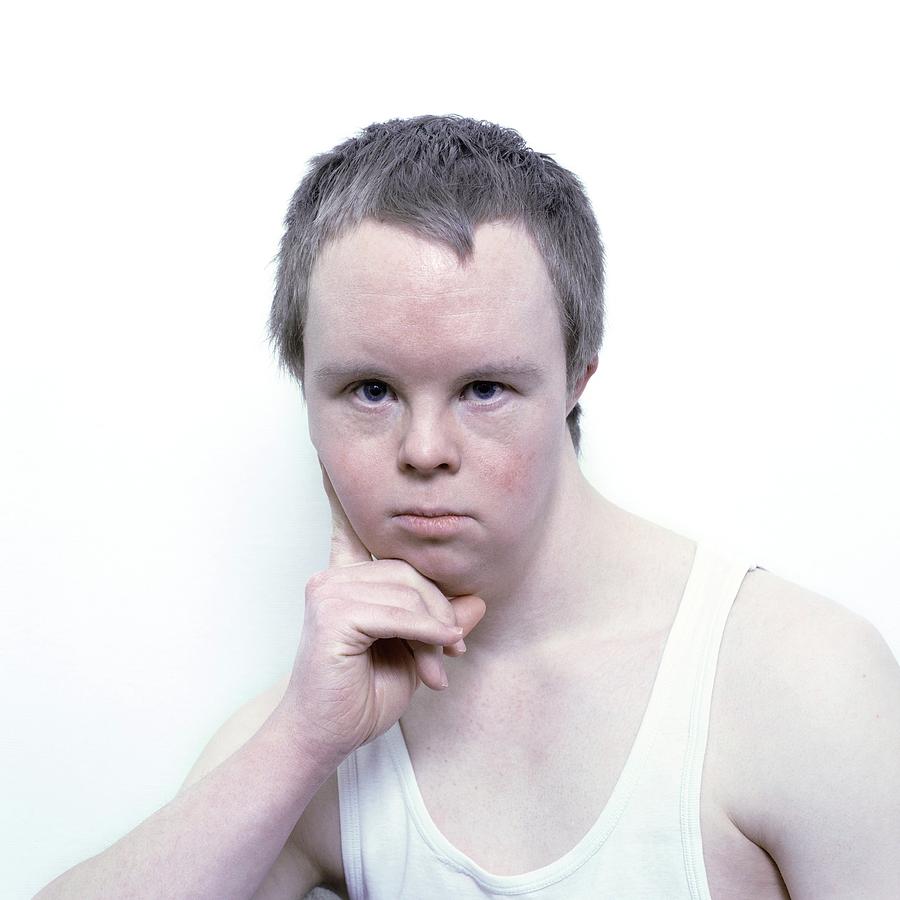 Face Of A Man With Downs Syndrome Photograph By Larry Dunstan Science