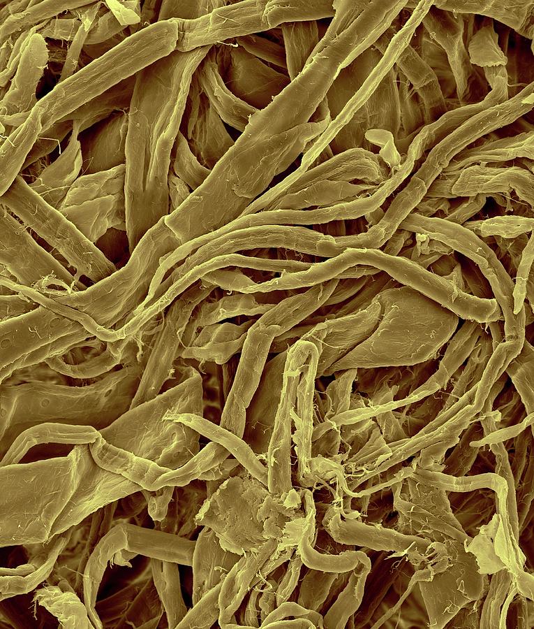 Facial Tissue Cellulose Fibres Photograph by Dennis Kunkel Microscopy/science Photo Library
