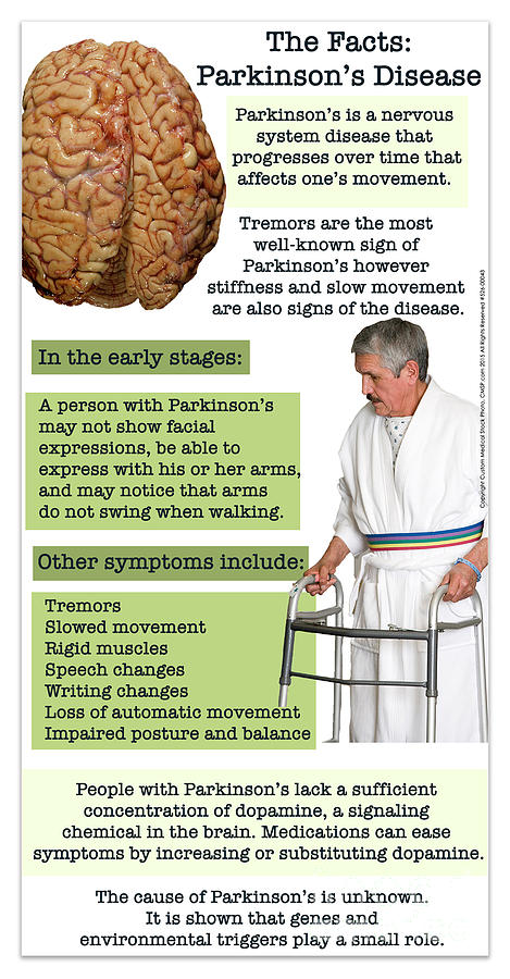 Facts of Parkinson's Disease Digital Art by Cmsp - Pixels