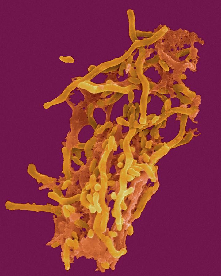 Faecal Coliform Bacteria Photograph By Dennis Kunkel Microscopyscience Photo Library Pixels 