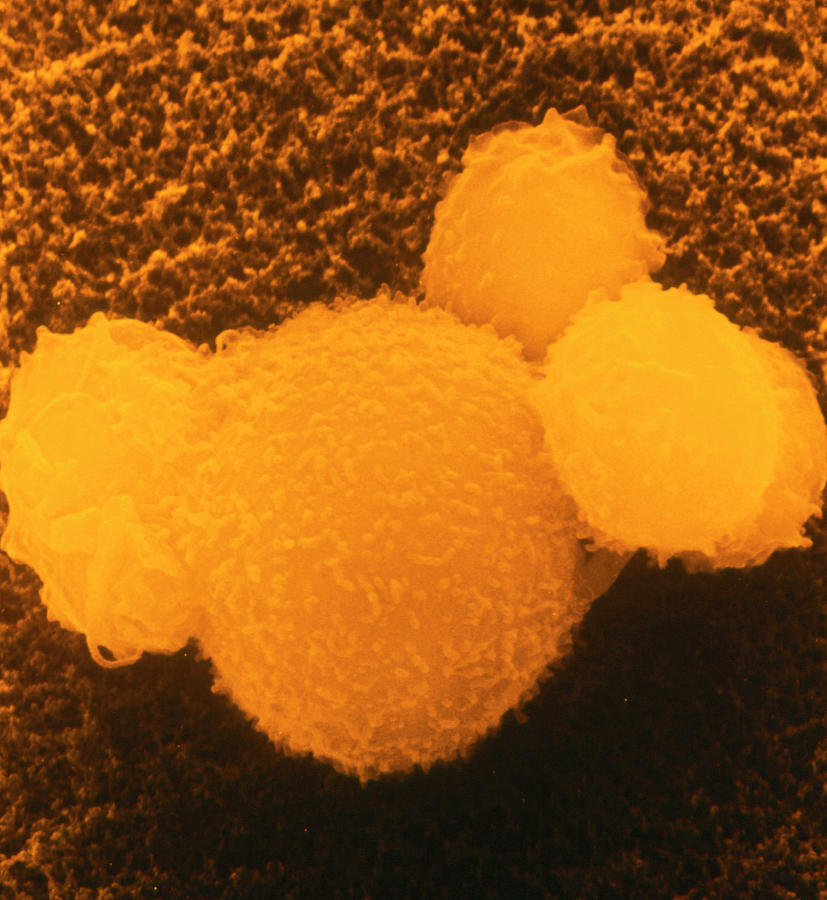 False-col Sem Of 4 T-lymphocytes Attacking Cell Photograph by Dr ...