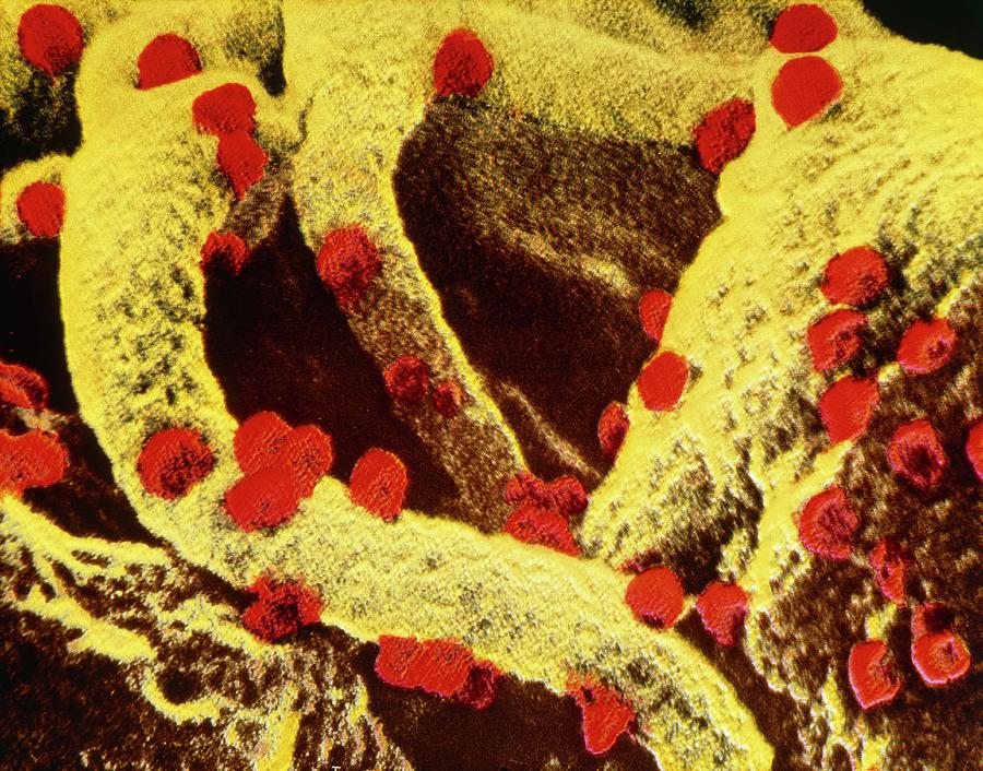 False-col Sem Of Aids Viruses & T4-lymphocyte Photograph by National Institute Of Health/science Photo Library