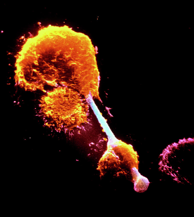 False-col Sem Of Macrophage Impaled On Asbestos Photograph by Institut Pasteur/unite Des Virus Oncongenes/science Photo Library